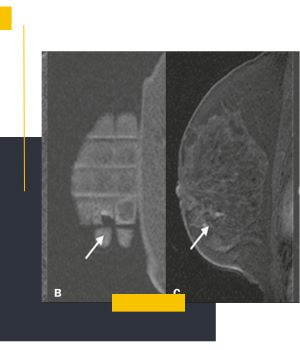 تفاوت نمونه‌برداری تحت گاید سونوگرافی، سی تی اسکن و MRI